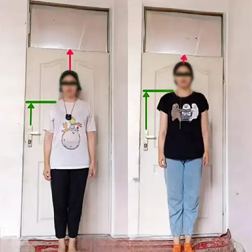 5 سانتی متر افزایش قد