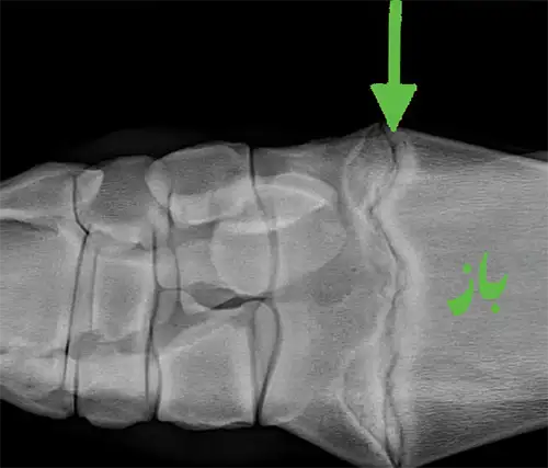 تصویر صفحات رشد باز