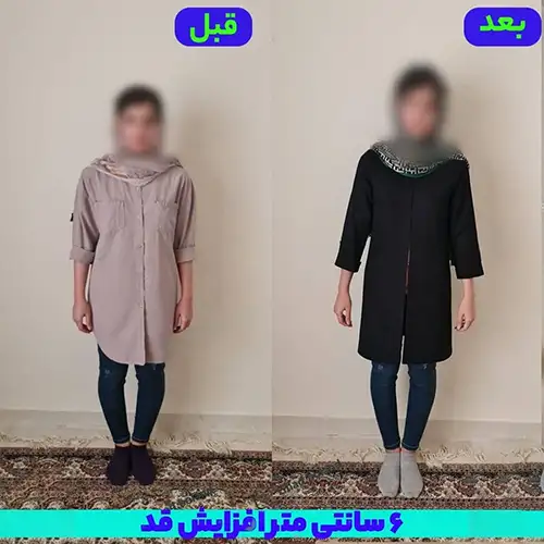 افزایش قد 6 سانتی